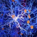 Учени откриха генна мутация, която може да намали риска от болестта на Алцхаймер