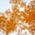 Недостигът на бежова мастна тъкан повишава риска от хипертония, инфаркт и инсулт