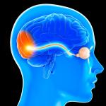 Зрителният нерв влиза в критериите за диагноза на множествена склероза