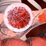 Нов дихателен тест може да промени из основи ранното откриване на рак на панкреаса