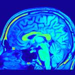 Промените във формата на мозъка могат да бъдат свързани с риск от деменция