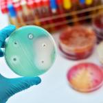 Швейцарски учени откриха ново оръжие срещу устойчиви на антибиотици бактерии