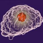 Лъч надежда в битката с рака на мозъка