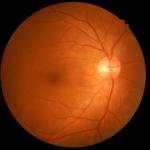Създават човешка ретина буквално от нулата