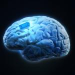 Усилиха човешката памет с мозъчен имплант