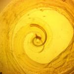 Най-ужасните паразити на света - пренебрегваните тропически болести