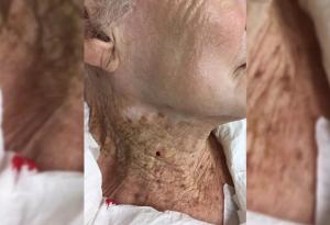 Ето какво се случва, когато 40 години носиш слънцезащитен крем по лицето, но не и по врата