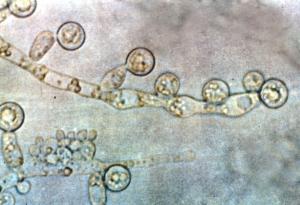 Антибиотиците могат потенциално да доведат до гъбични инфекции, тъй като смущават имунната система на червата