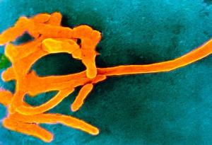Възможно ли е ендометриозата да се причинява от бактерия? 