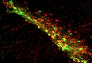 Откритие, свързано с допамина, би могло да обясни болестта на Паркинсон