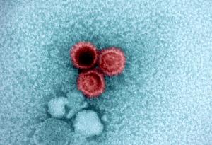 Свързаха лупуса с вирус, който над 95 процента от нас носят – и вече знаем защо