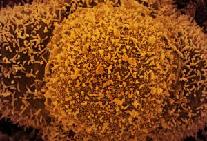 Вариантът Делта предизвиква различни симптоми от „класическия“ COVID-19