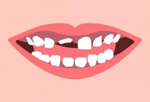 Кога и защо се налага да извадим млечния зъб 