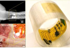 Създадоха роботизирани сензорни реснички, които следят вътрешни биомаркери за откриване и оценка на заболявания на дихателните пътища