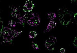 Затлъстяването нарушава работата на митохондриите и вече знаем защо