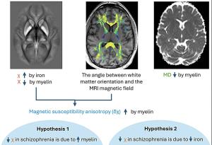 Шизофренията е свързана с дефицит на желязо и миелин в мозъка
