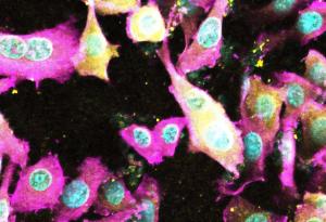 Открит е нов токсин на E. coli, който уврежда червата и застрашава здравето