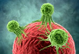 Отбелязваме световния ден за борба с рака - медицината бележи забележителен прогрес в лечението