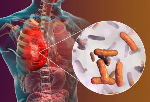 Ново лекарство може да промени живота на някои пациенти с муковисцидоза