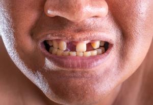 Учени откриха как да накарат зъбите да поникнат наново