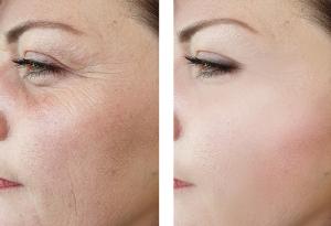 Най-важният признак за остаряването при жените — и това съвсем не са бръчките