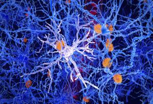 Учени откриха генна мутация, която може да намали риска от болестта на Алцхаймер