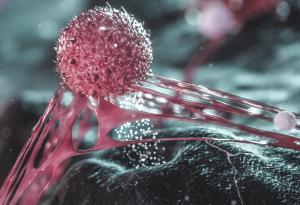 Ваксина срещу човешкия папиломен вирус може да помогне на жени с предракови клетки