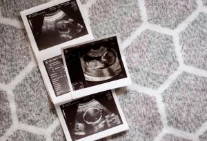 Колко точно трае всеки триместър