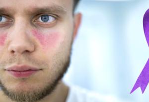 Стартира национална кампания „Разпознай Лупуса“