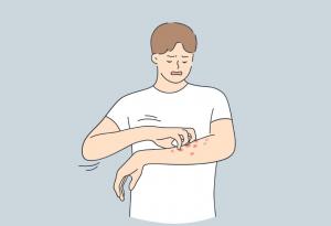 Науката разнищва тайната на сърбежите