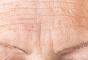 Бръчките ни придават ненадежден вид, установиха немски учени 