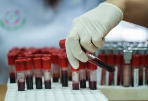 Откриха микропластмаса в човешката кръв в първо по рода си изследване