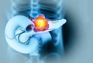 Учени във Франция тестват иРНК терапия за лечение на рак на панкреаса