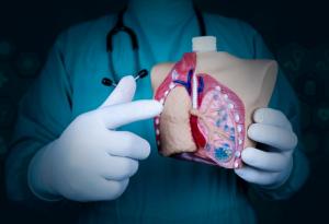 Метод с изкуствен интелект помага за идентифициране на пациенти, изложени на риск от смъртоносна белодробна емболия