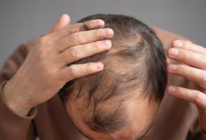 Ново проучване разкрива протеин, който стимулира растежа на косата при възрастни