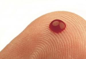 Капчица кръв може да разкрие нивото на хормоните на стреса в нашето тяло 