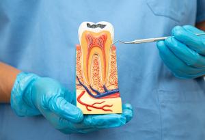 Учени създадоха гел, който възстановява зъбния емайл и може да сложи край на кариеса