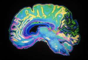Малкият мозък разполага с функция, за която дори не подозирахме, сочи ново изследване