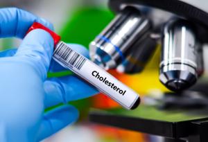 Създадоха молекули за контролиране на активността на холестерола с помощта на светлина
