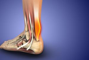 Болка в сухожилията: кои са най-честите причини и как да я облекчим?