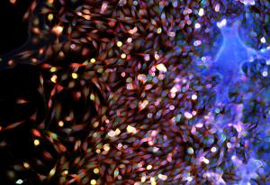 Вероятно никога няма да има универсален лек срещу рак, сочи мащабен 9-годишен анализ