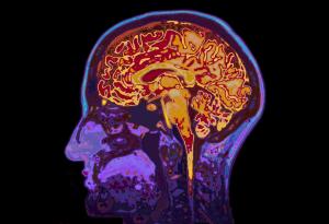 Нова терапия срещу изключително агресивен вид мозъчен тумор дава обещаващи резултати на ранен етап