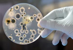 Историята на австралийския учен, който проверил дали пръдните разпространяват болести