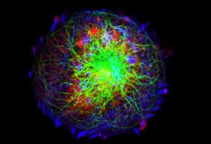 Откриха нов начин за лечение на невробластом