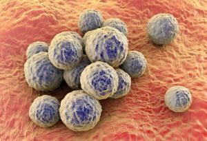 Учени откриха съединение, което унищожава супербактерията златист стафилокок