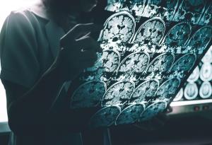 Откриха нови механизми, които вероятно водят до развитие на Алцхаймер