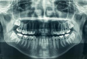 Ето как експлодиращите звезди са образували калция в нашите зъби и кости