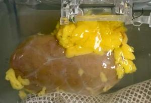 Пробив: Създадоха „универсален“ бъбрек, който пасва на която и да е кръвна група