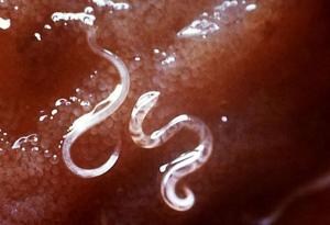 Жена мина през рояк мушички и се озова с паразитен червей, размножаващ се в очите й