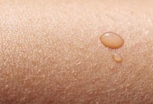 Кожата може да определя времето